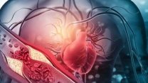 Kalp damar tıkanıklıkları neden olur? Kalp damar sağlığı için nelere dikkat edilmeli? 